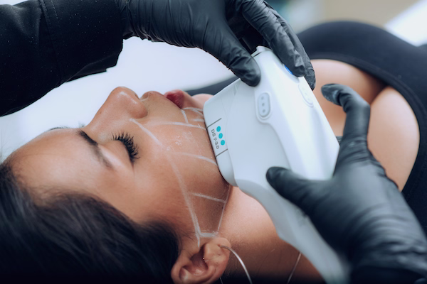 Tratamiento Ultherapy con ultrasonido focalizado en IVLU Bogotá